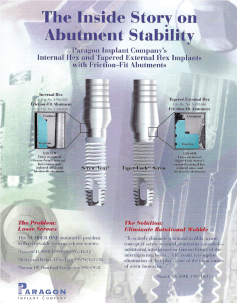 The Inside Story of Abutments Stability Brochure