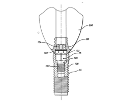 Multi-part, multi-positionable abutment for use with dental
